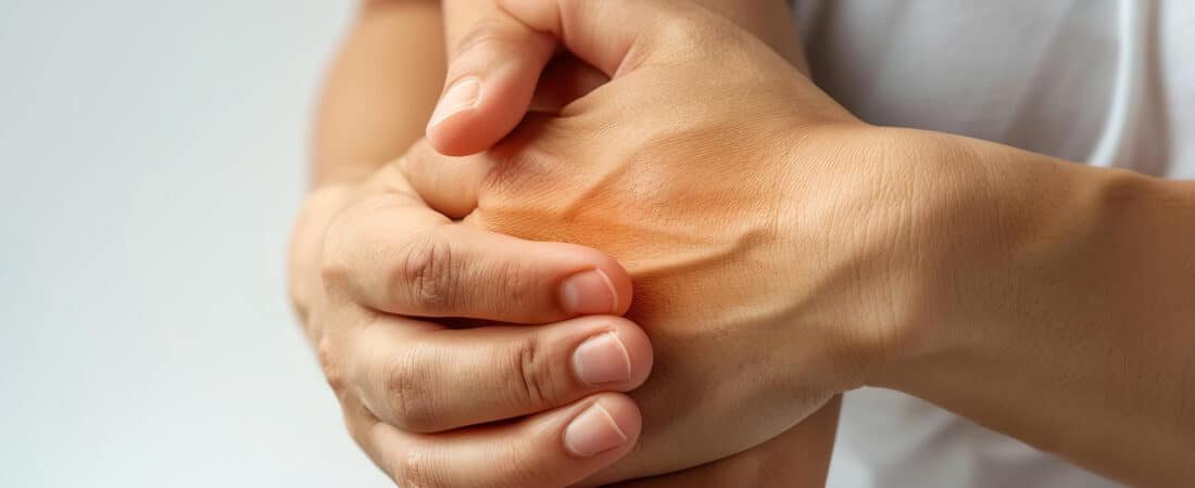 Rizartrose aposentadoria: quando a artrose no polegar pode gerar benefício no INSS