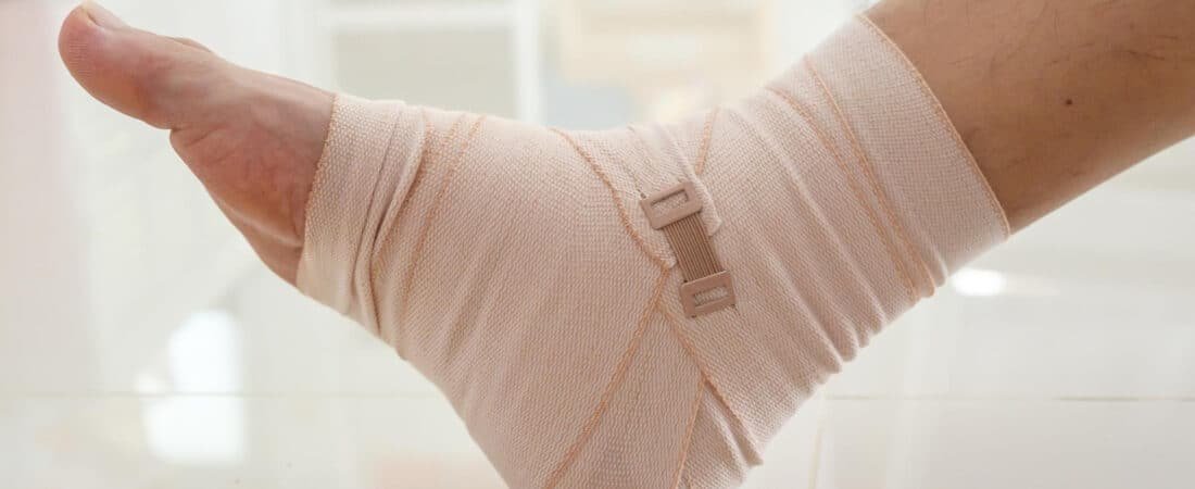 Fratura de calcâneo gera aposentadoria: entenda quando a lesão no calcanhar pode dar direito ao benefício